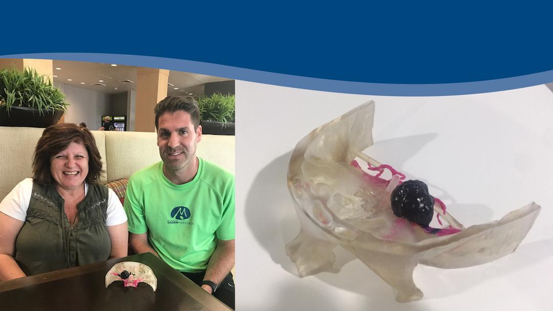 3D Printed Tumor