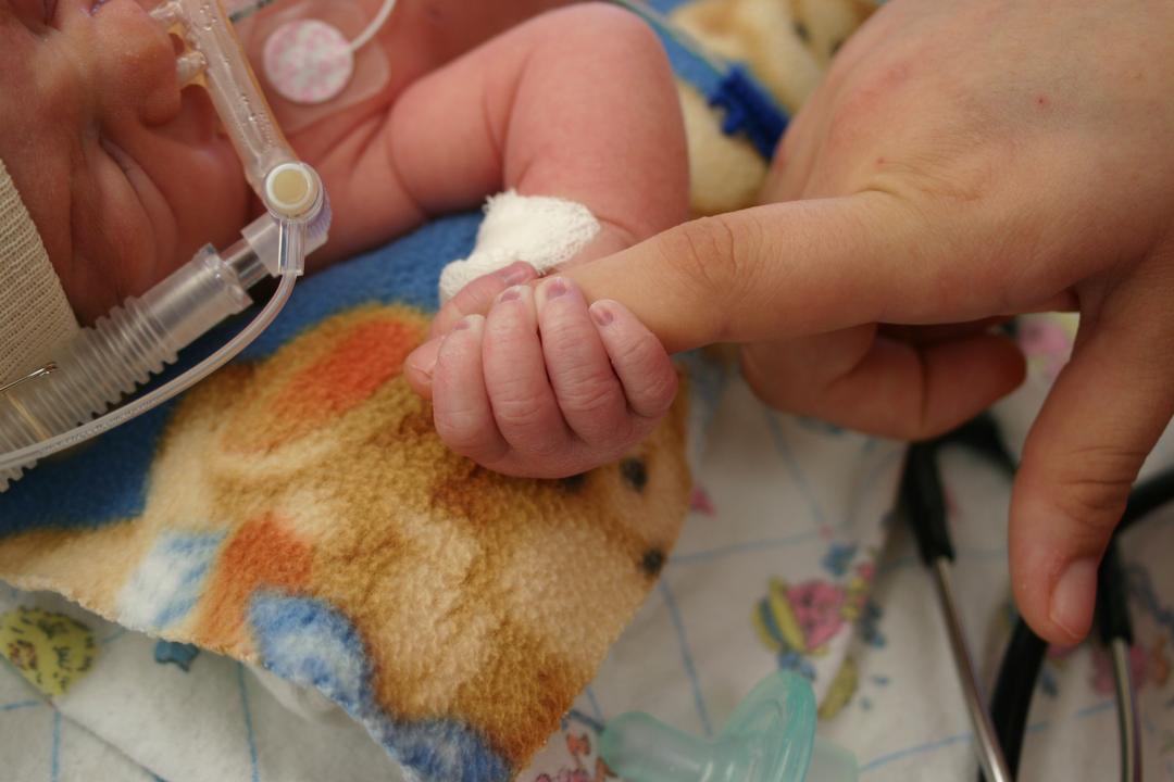 Neonatology infant in hospital NICU